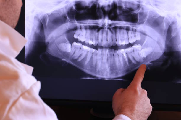 Best Weekend Emergency Dentist in Underwood Petersville, AL