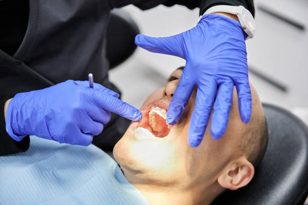 Best Urgent Care for Lost Fillings or Crowns in Underwood Petersville, AL