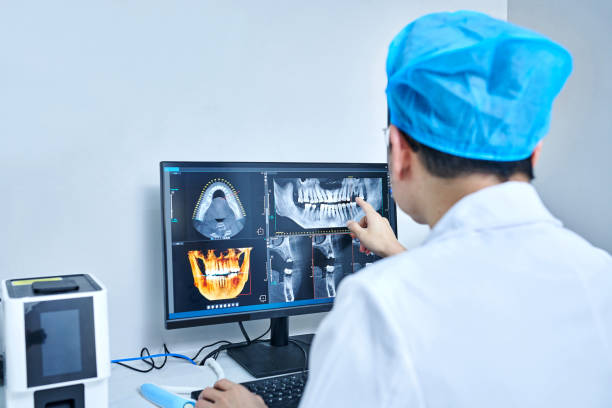 Best Emergency Wisdom Teeth Removal in Underwood Petersville, AL