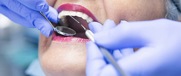 Best Emergency Denture Repair in Underwood Petersville, AL
